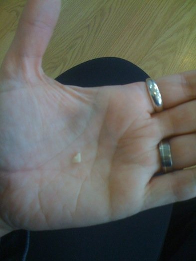 The bit of tooth I bit off.